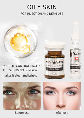 Oily Youth Serum Injection ‎ তেল নিয়ন্ত্রণ মেসোথেরাপি ত্বকের চিকিৎসা